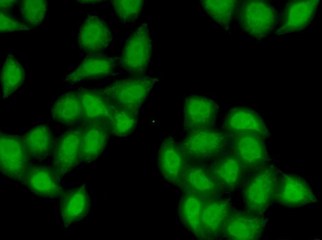 Anti-SS18 Antibody (CAB6990)