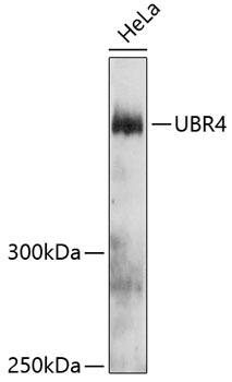 Anti-UBR4 Antibody (CAB12193)