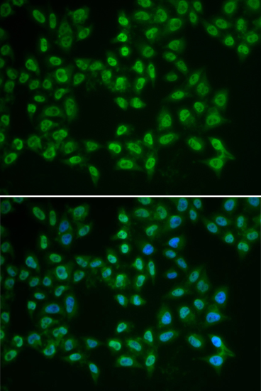 Anti-BTK Antibody (CAB1576)