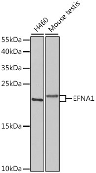 Anti-EFNA1 Antibody (CAB5341)