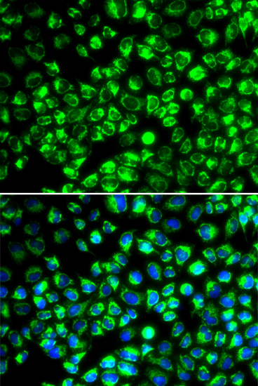 Anti-ATP6AP2 Antibody (CAB6531)