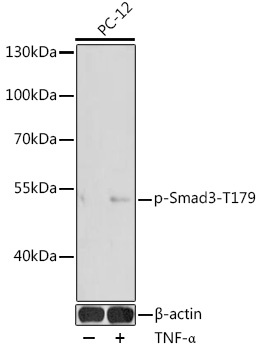 Anti-Phospho-SMAD3-T179 Antibody (CABP0554)