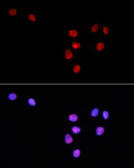 Anti-Alexa Fluor 594-conjugated Goat Anti-Rabbit IgG (H+L) Antibody