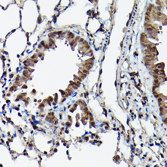 Anti-Ataxin 3 Antibody (CAB1243)