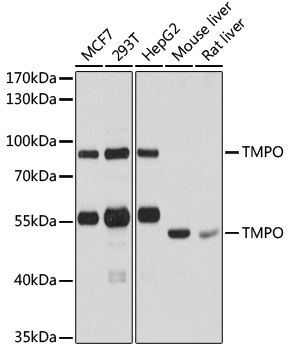 Anti-TMPO Antibody [KO Validated] (CAB2534)