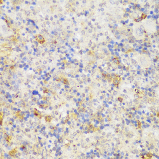 Anti-GCC2 Antibody (CAB13814)