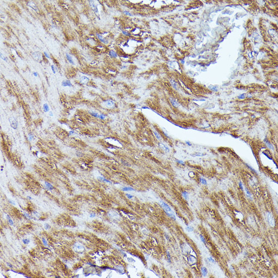 Anti-N-WASP Antibody (CAB2576)