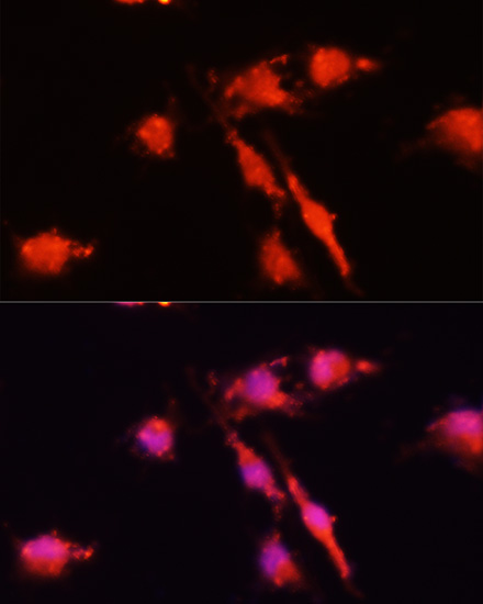 Anti-BDNF Antibody (CAB1307)