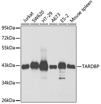 Anti-TARDBP Antibody (CAB1183)