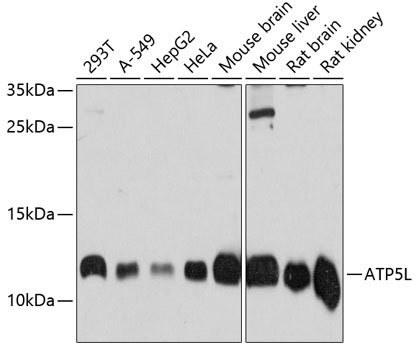 Anti-ATP5L Polyclonal Antibody (CAB9178)