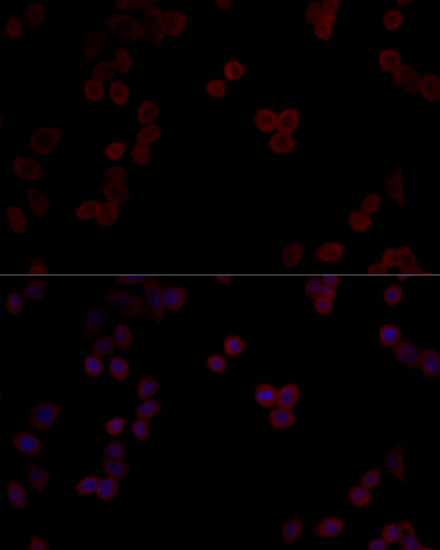 Anti-PPP5C Antibody (CAB11712)