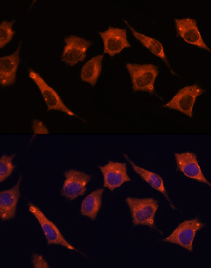 Anti-MALT1 Antibody (CAB2144)