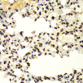 Anti-SUMO2 Antibody (CAB1523)