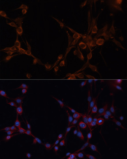 Anti-ALDH6A1 Antibody (CAB3309)