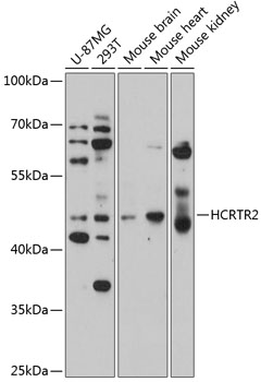 Anti-HCRTR2 Antibody (CAB3057)