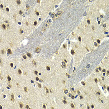 Anti-MAX Antibody (CAB2157)