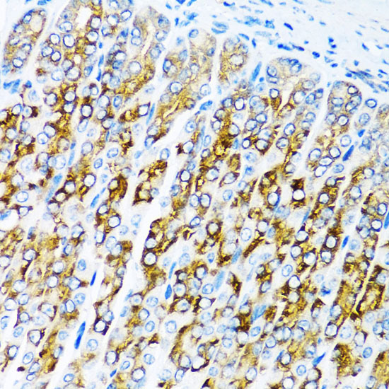 Anti-ACVR1C Antibody (CAB0678)