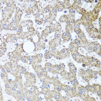 Anti-TSG101 Antibody (CAB1692)