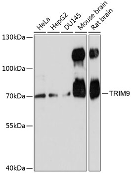 Anti-TRIM9 Antibody (CAB13896)