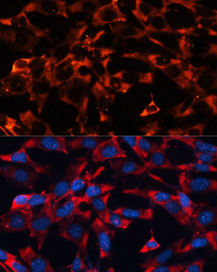 Anti-MAPK1/MAPK3 Antibody (CAB16736)