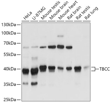 Anti-TBCC Antibody (CAB17537)