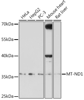 Anti-MT-ND1 Antibody (CAB18316)