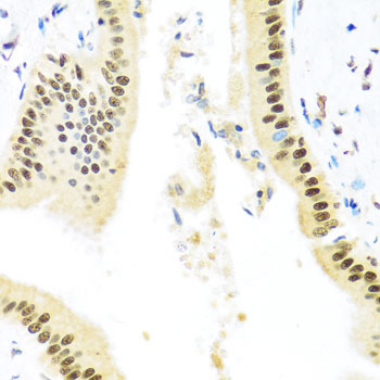 Anti-ZBTB17 Polyclonal Antibody (CAB8463)