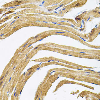 Anti-CEP164 Polyclonal Antibody (CAB9964)