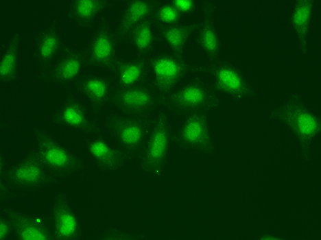 Anti-POLD1 Antibody (CAB5323)