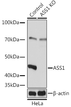 Anti-ASS1 Antibody [KO Validated] (CAB16767)