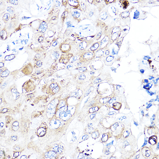 Anti-VEGFA Antibody (CAB0280)