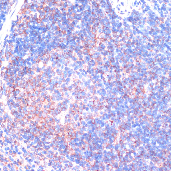 Anti-RPS6KA2 Antibody (CAB16305)