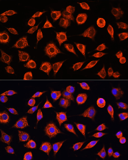 Anti-CRP Antibody (CAB0224)