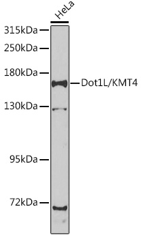 Anti-Dot1L/KMT4 Antibody (CAB7619)