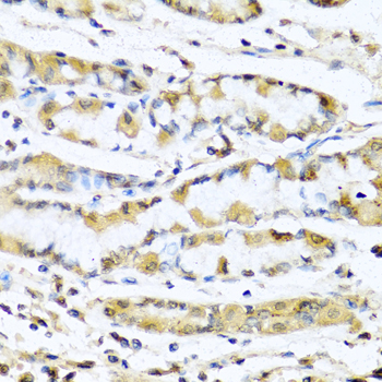 Anti-GNRH1 Antibody (CAB5625)