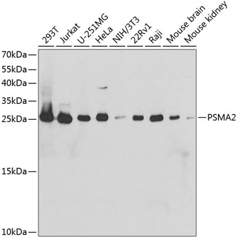 Anti-PSMA2 Antibody (CAB2504)