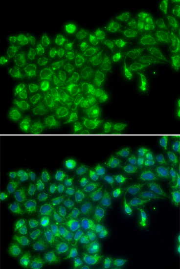 Anti-TNFSF13 Antibody (CAB13570)