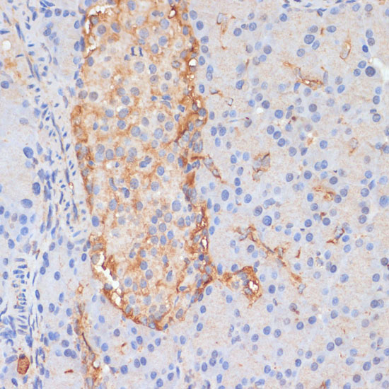 Anti-DLL1 Antibody (CAB14277)