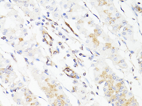 Anti-Vimentin Antibody [KO Validated] (CAB11952)