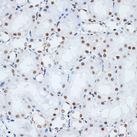 Anti-HMGB1 Antibody [KO Validated] (CAB0719)