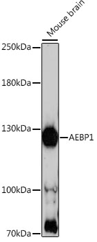 Anti-AEBP1 Antibody (CAB16340)