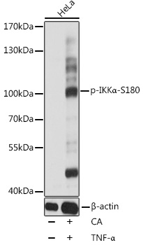 Phospho-IKKa-S180 pAb (CABP0506)