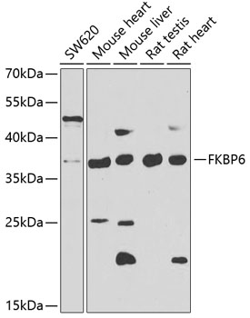 Anti-FKBP6 Antibody (CAB7013)