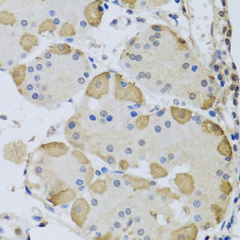 Anti-ANAPC10 Polyclonal Antibody (CAB8330)