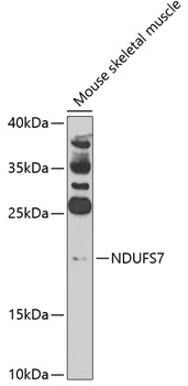 Anti-NDUFS7 Antibody (CAB7862)