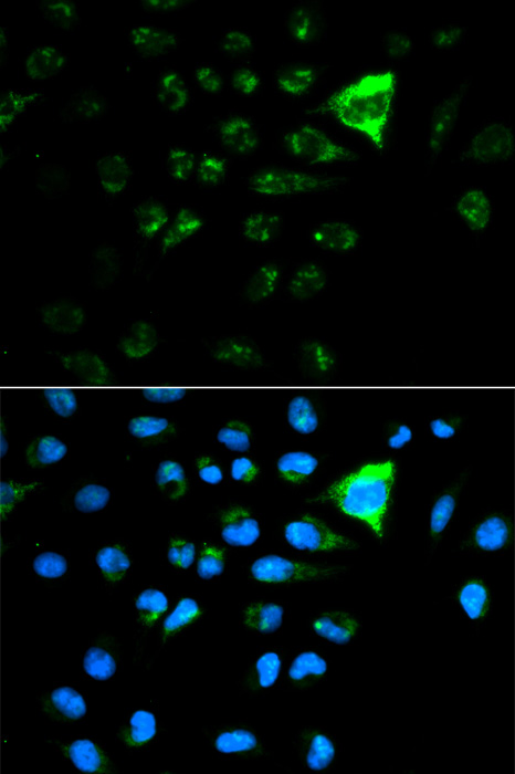 Anti-CDKN1A/p21CIP1 Antibody (CAB11454)