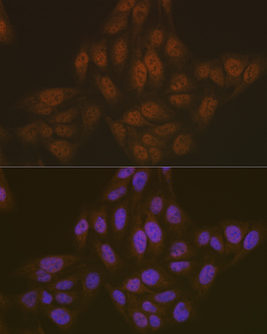 Anti-ASC / TMS1 Antibody (CAB16672)