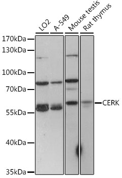 Anti-CERK Antibody (CAB15889)