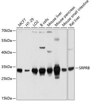 Anti-SRPRB Antibody (CAB10591)