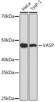 Anti-VASP Antibody (CAB8862)